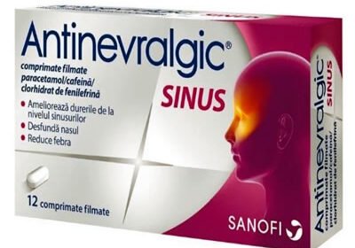 Antinevralgic sinus pareri